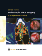 Endoscopic Sinus Surgery: A Comprehensive Atlas