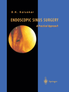Endoscopic Sinus Surgery: A Practical Approach