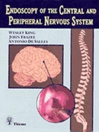 Endoscopy of the Central and Peripheral Nervous System - King, Wesley, and Frazee, John, and DeSalles, Antonio A.