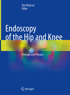 Endoscopy of the Hip and Knee: Principle and Practice