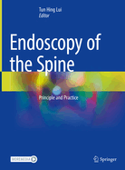 Endoscopy of the Spine: Principle and Practice