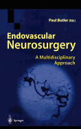 Endovascular Neurosurgery: A Multidisciplinary Approach
