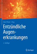 Entzundliche Augenerkrankungen