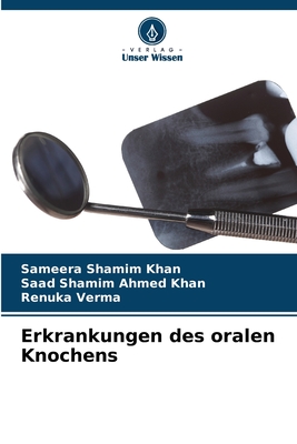 Erkrankungen des oralen Knochens - Shamim Khan, Sameera, and Shamim Ahmed Khan, Saad, and Verma, Renuka