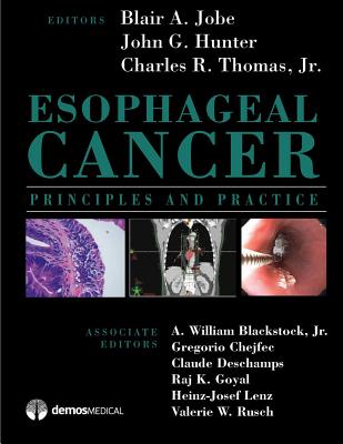 Esophageal Cancer: Principles and Practice - Jobe, Blair A, MD (Editor), and Charles, Thomas R, MD (Editor), and Hunter, John G, MD (Editor)