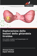 Esplorazione delle lesioni della ghiandola tiroidea