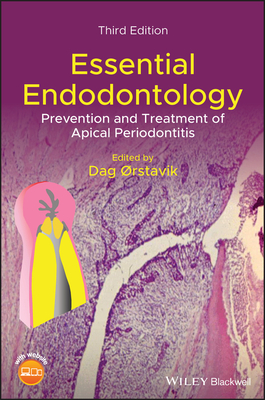 Essential Endodontology: Prevention and Treatment of Apical Periodontitis - Orstavik, Dag (Editor)