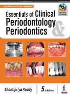 Essentials of Clinical Periodontology & Periodontics