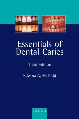 Essentials of Dental Caries: The Disease and Its Management - Kidd, Edwina A M