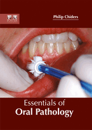 Essentials of Oral Pathology