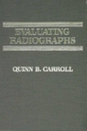 Evaluating Radiographs - Carroll, Quinn B