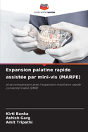 Expansion palatine rapide assist?e par mini-vis (MARPE)