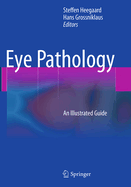 Eye Pathology: An Illustrated Guide