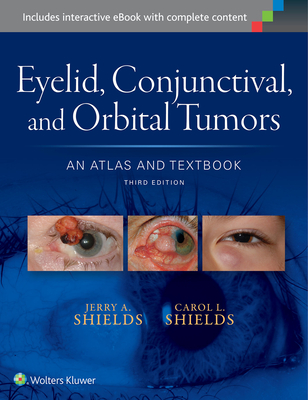 Eyelid, Conjunctival, and Orbital Tumors: An Atlas and Textbook - Shields, Jerry A., Dr., and Shields, Carol L., Dr.