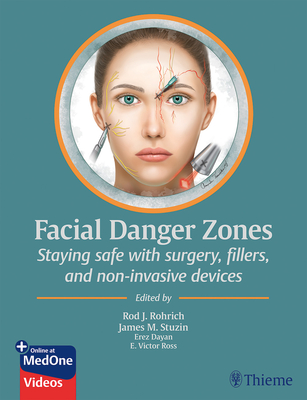 Facial Danger Zones: Staying Safe with Surgery, Fillers, and Non-Invasive Devices - Rohrich, Rod J (Editor), and Stuzin, James M (Editor), and Dayan, Erez (Editor)