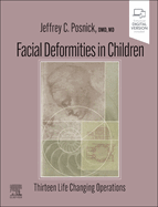 Facial Deformities in Children: Thirteen Life Changing Operations