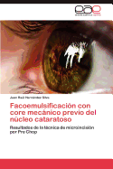 Facoemulsificacion Con Core Mecanico Previo del Nucleo Cataratoso