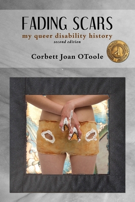 Fading Scars: My Queer Disability History, 2nd Edition - Otoole, Corbett Joan, and Yi, Chun-Shan (Sandie) (Photographer)