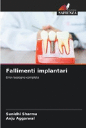 Fallimenti implantari