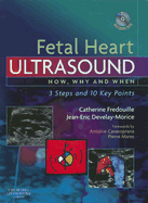Fetal Heart Ultrasound: How, Why and When