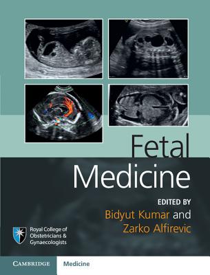 Fetal Medicine - Kumar, Bidyut (Editor), and Alfirevic, Zarko (Editor)