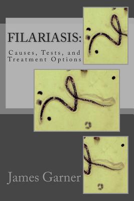 Filariasis: Causes, Tests, and Treatment Options - Stanley MD, Leonard (Editor), and Garner Ma, James P