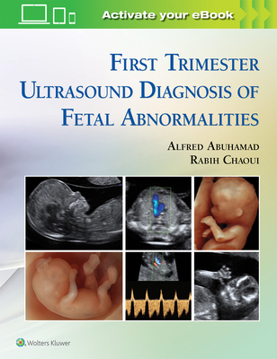 First Trimester Ultrasound Diagnosis of Fetal Abnormalities - Abuhamad, Alfred Z, MD, and Chaoui, Rabih, MD