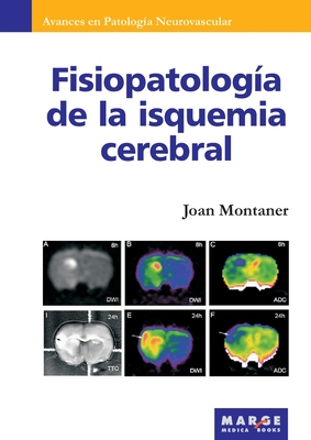 Fisiopatolog?a de la isquemia cerebral - Montaner, Joan