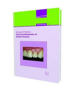 Fixed Prosthodontics in Dental Practice: Prosthodontics 4