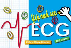Flip and See ECG - Cohn, Elizabeth Gross, RN, MS, NP, Dnsc, and Gilroy-Doohan, Mary, MD, Facep