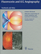 Fluorescein and ICG Angiography: Textbook and Atlas