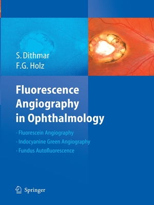 Fluorescence Angiography in Ophthalmology - Dithmar, Stefan, and Holz, Frank G