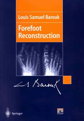 Forefoot Reconstruction - Barouk, Louis Samuel