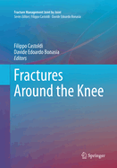 Fractures Around the Knee