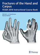 Fractures of the Hand and Carpus: Fessh 2018 Instructional Course Book