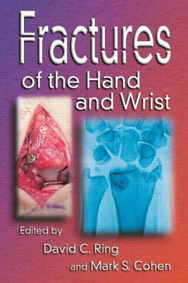 Fractures of the Hand and Wrist - Ring, David C (Editor), and Cohen, Mark (Editor)