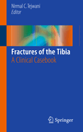 Fractures of the Tibia: A Clinical Casebook