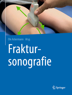 Fraktursonografie - Ackermann, Ole (Editor)