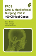 FRCS (Oral & Maxillofacial Surgery) Part 2: 100 Clinical Cases