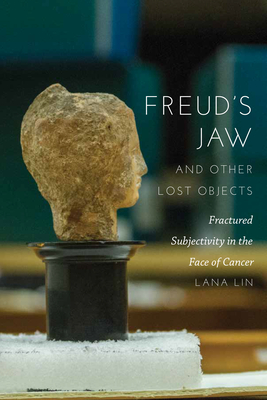 Freud's Jaw and Other Lost Objects: Fractured Subjectivity in the Face of Cancer - Lin, Lana