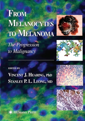 From Melanocytes to Melanoma: The Progression to Malignancy - Hearing, Vincent J (Editor), and Leong, Stanley P L (Editor)