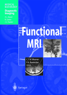 Functional MRI