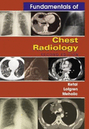 Fundamentals of Chest Radiology