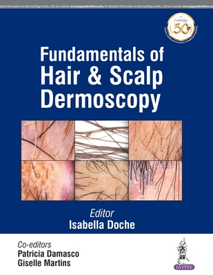 Fundamentals of Hair and Scalp Dermoscopy - Doche, Isabella, and Damasco, Patricia, and Martins, Giselle