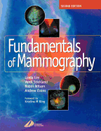 Fundamentals of Mammography