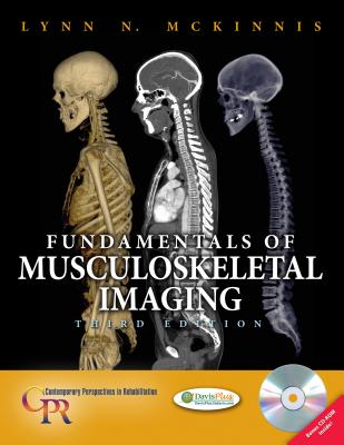 Fundamentals of Musculoskeletal Imaging - McKinnis, Lynn N, PT, Ocs