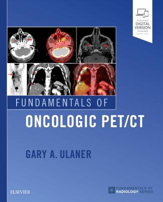 Fundamentals of Oncologic Pet/CT - Ulaner, Gary A, MD, PhD