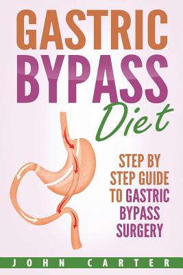 Gastric Bypass Diet: Step By Step Guide to Gastric Bypass Surgery - Carter, John