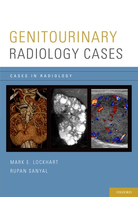 Genitourinary Radiology Cases - Lockhart, Mark E (Editor), and Sanyal, Rupan (Editor)