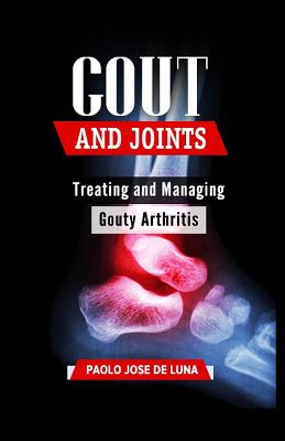 Gout and Joints: Treating and Managing Gouty Arthritis - Jose De Luna, Paolo